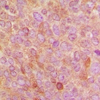 Cytochrome P450 24A1 Rabbit Polyclonal Antibody