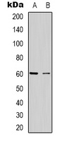 CABLES2 Rabbit Polyclonal Antibody
