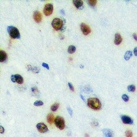 CABLES2 Rabbit Polyclonal Antibody