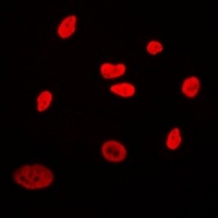 CABLES2 Rabbit Polyclonal Antibody