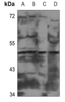 CADM2 Rabbit Polyclonal Antibody