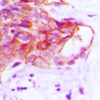 CADM2 Rabbit Polyclonal Antibody