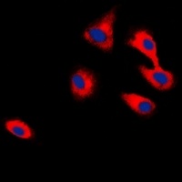 CADM2 Rabbit Polyclonal Antibody