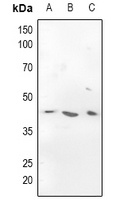 CADM3 Rabbit Polyclonal Antibody