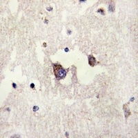 CADM3 Rabbit Polyclonal Antibody