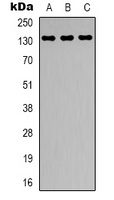 CARD11 Rabbit Polyclonal Antibody