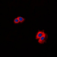 CARD11 Rabbit Polyclonal Antibody