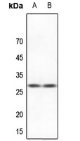 HSPB2 Rabbit Polyclonal Antibody