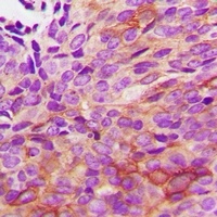HSPB2 Rabbit Polyclonal Antibody