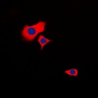 HSPB2 Rabbit Polyclonal Antibody