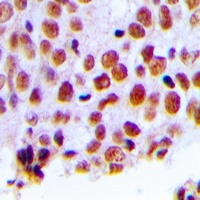 MSH2 Rabbit Polyclonal Antibody
