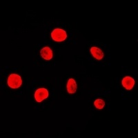 MSH2 Rabbit Polyclonal Antibody