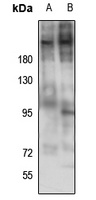 Laminin beta 2 Rabbit Polyclonal Antibody