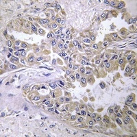 Laminin beta 2 Rabbit Polyclonal Antibody