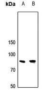 APBB2 Rabbit Polyclonal Antibody