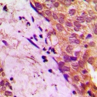APBB2 Rabbit Polyclonal Antibody