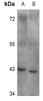 B4GALT1 Rabbit Polyclonal Antibody