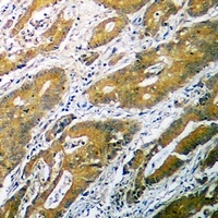 B4GALT1 Rabbit Polyclonal Antibody
