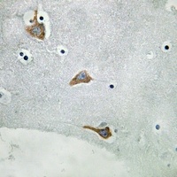 C1QL2 Rabbit Polyclonal Antibody