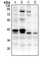 CCNB1IP1 Rabbit Polyclonal Antibody