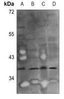 GGH Rabbit Polyclonal Antibody