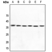 HLA-DOA Rabbit Polyclonal Antibody