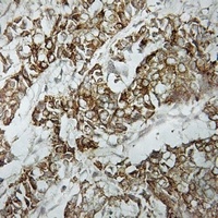 HLA-DOA Rabbit Polyclonal Antibody
