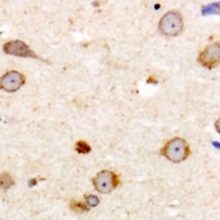 ME3 Rabbit Polyclonal Antibody