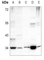 PEX2 Rabbit Polyclonal Antibody