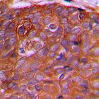 PEX2 Rabbit Polyclonal Antibody