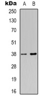 NDRG4 Rabbit Polyclonal Antibody