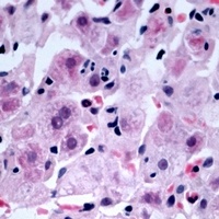 NDRG4 Rabbit Polyclonal Antibody