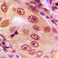 SPAK Rabbit Polyclonal Antibody