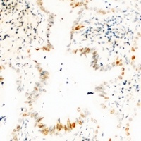 USP36 Rabbit Polyclonal Antibody
