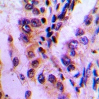 BAG3 Rabbit Polyclonal Antibody
