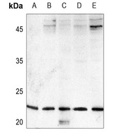 FGF9 Rabbit Polyclonal Antibody