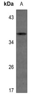IGFBP1 Rabbit Polyclonal Antibody