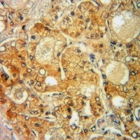 PORIN Rabbit Polyclonal Antibody