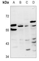 ZNF384 Rabbit Polyclonal Antibody