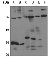 EDG5 Rabbit Polyclonal Antibody