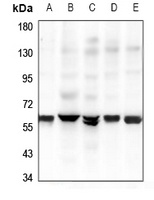 GPR37L1 Rabbit Polyclonal Antibody
