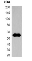 EBFP-tag Rabbit Polyclonal Antibody