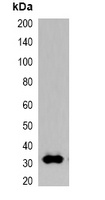 GFP-tag Rabbit Polyclonal Antibody