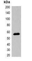 MBP-tag Rabbit Polyclonal Antibody