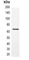 MBP-tag Rabbit Polyclonal Antibody