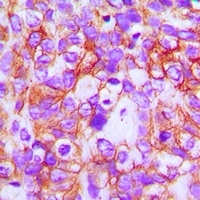 ABCB5 Mouse Monoclonal Antibody