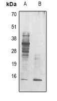 Acetyl Lysine Mouse Monoclonal Antibody