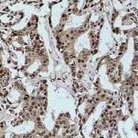 Acetyl Lysine Mouse Monoclonal Antibody