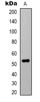 Alpha-tubulin (Acetyl-K40) Mouse Monoclonal Antibody