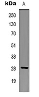 BCL2 Mouse Monoclonal Antibody